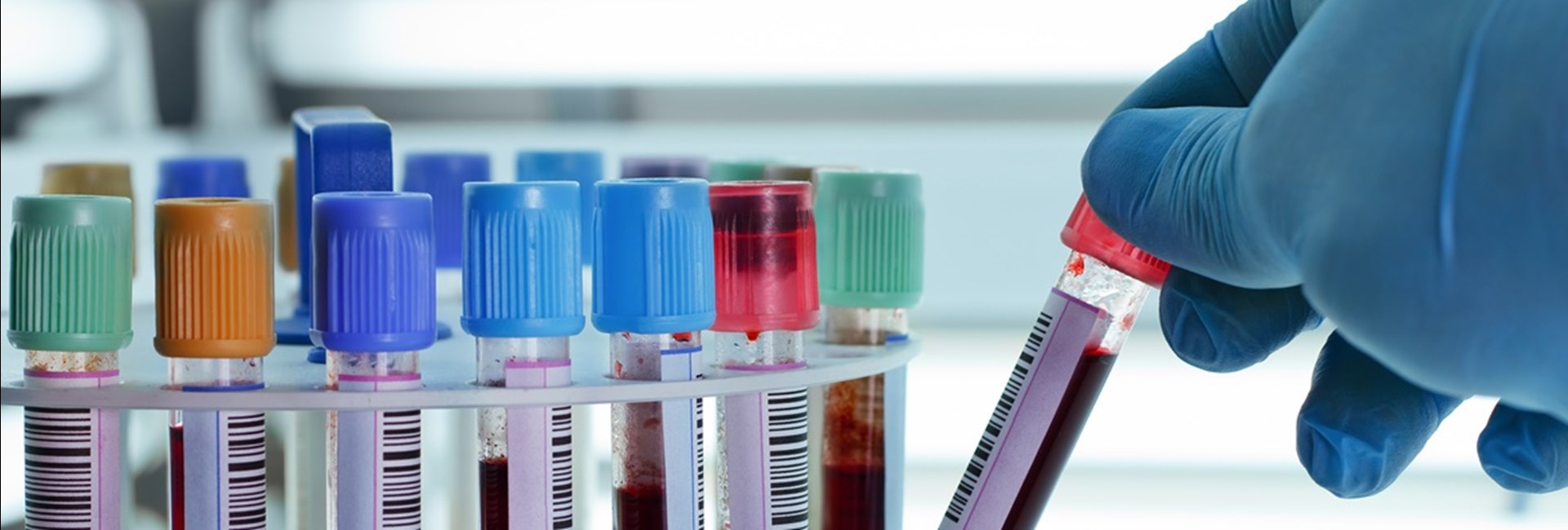blood tubes for coronavirus test